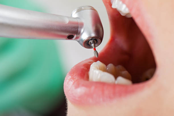 Best Same-Day Emergency Dentist in Oaklawn Sunview, KS